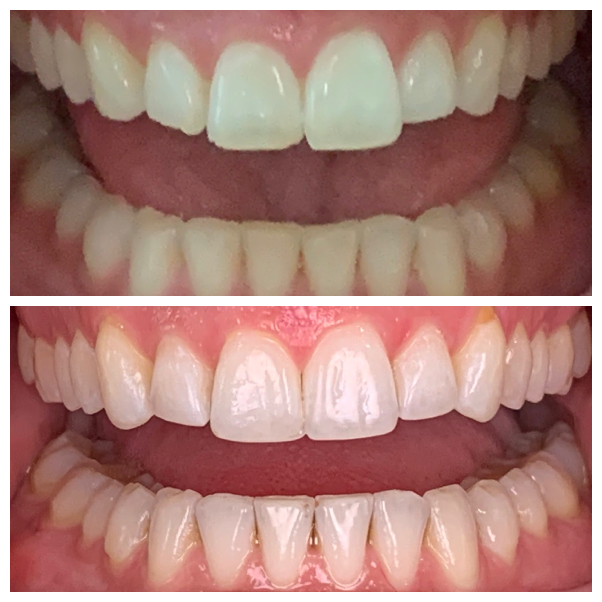 Pleasant Smiles | Pediatric Dentistry, Invisalign reg and Night Guards