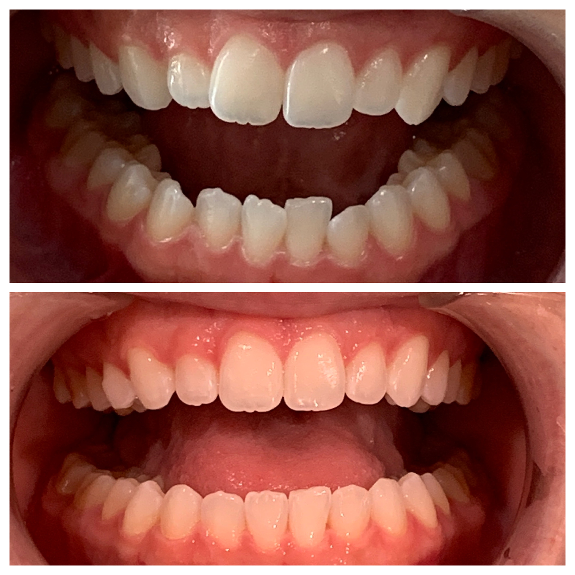 Pleasant Smiles | Dental Fillings, Dentures and Preventative Program