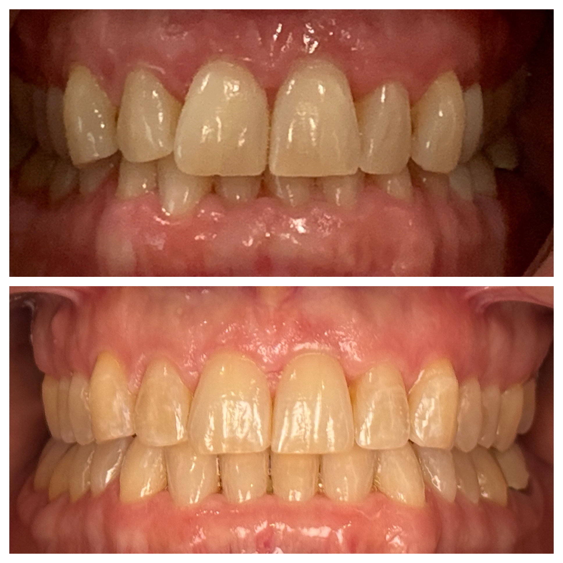 Pleasant Smiles | Veneers, Implant Dentistry and Dental Fillings